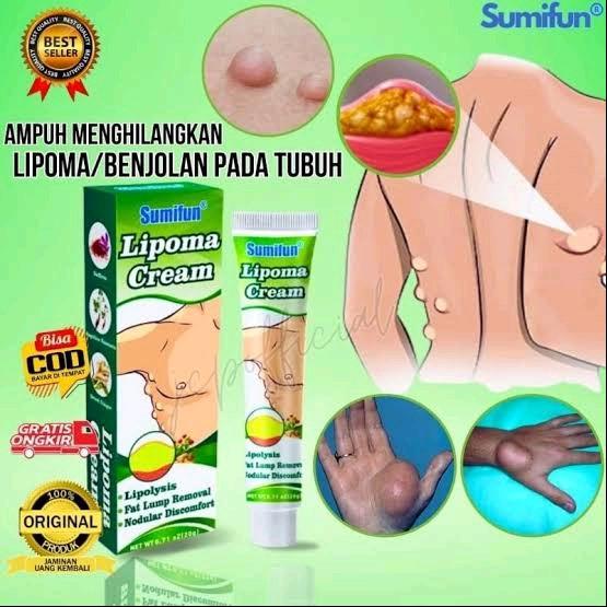 sumifun lipoma solusi ampun menghilangkan benjolan 2