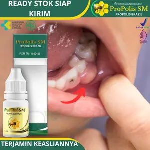 Propolis SM - Untuk Abses Gigi / Abses Gusi, Benjolan Di Gusi, Pengempis Abses Gigi / Gusi Bengkak