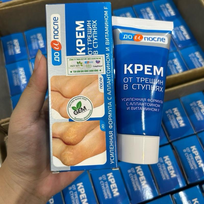  Kem nứt gót chân Kpem hàng Nga 50ml 