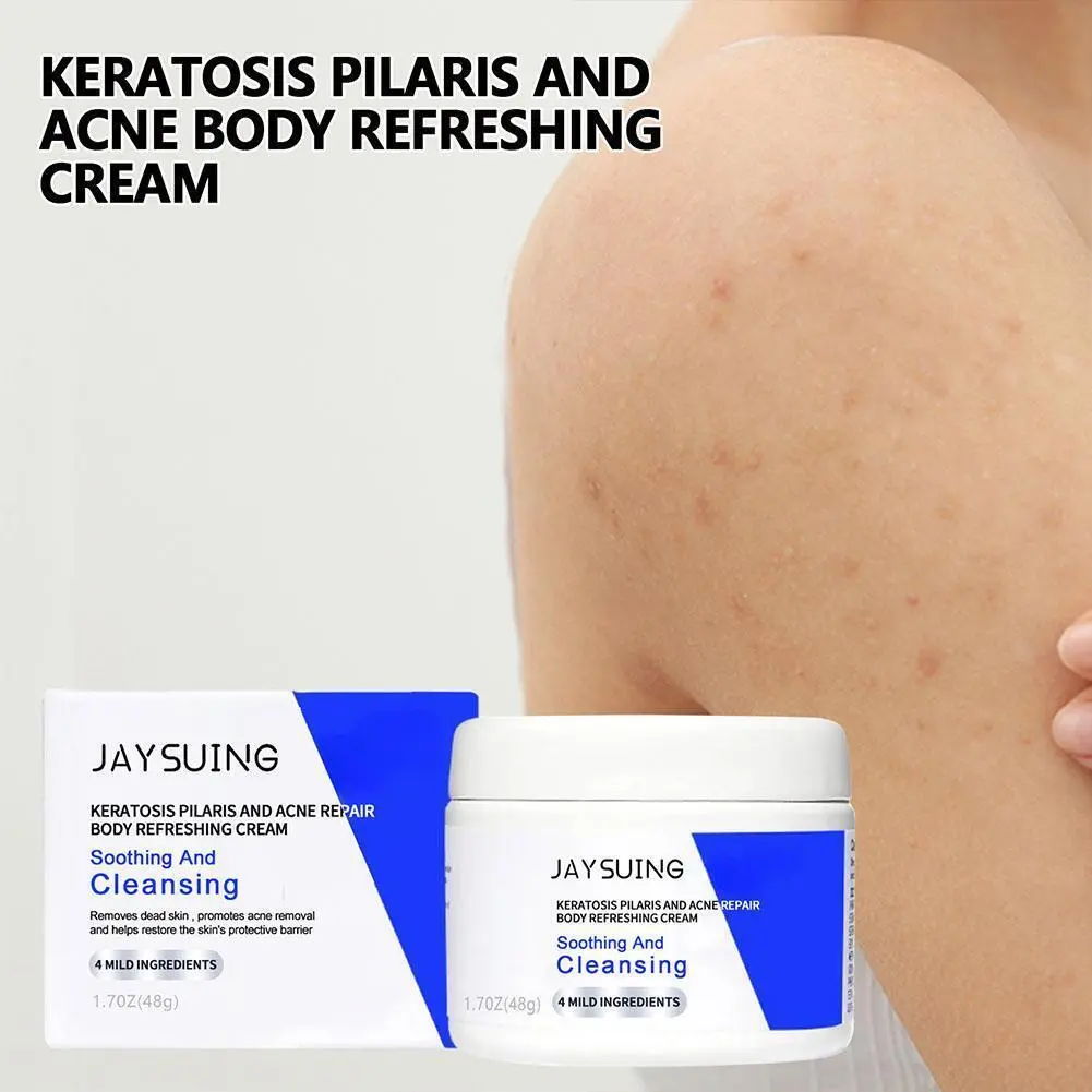 Kem Phục Hồi Da Keratosis Pilaris, 48G, Làm Sạch Cơ Thể, Sửa Chữa Lưng Và Vai, Mụn Trứng Cá, Da Mịn Màng
