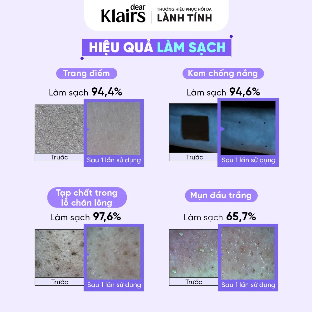 [Hứa Ngân][TẶNG FULLSIZE] Nước tẩy trang Dear Klairs Supple Preparation Unscented Cleansing Water 400ml | BigBuy360 - bigbuy360.vn