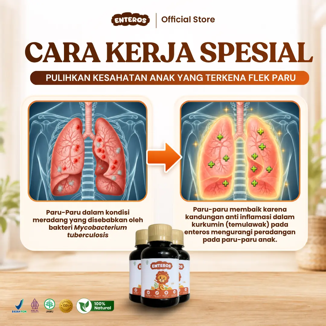 Atasi Flek Paru |  Enteros Kids Sirup Herbal Anak 130ml | Halal & BPOM