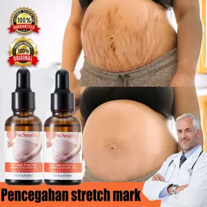 Stretchmarks Treatment Oil bpom minyak stretchmarks krim stretchmarks bio oil stretchmarks oil serum stretchmarks repair stretchmarks treatment stretchmarks