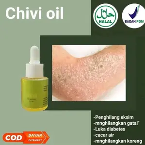 CHIVIOIL PENGHILANG BEKAS LUKA DAN GATAL GATAL