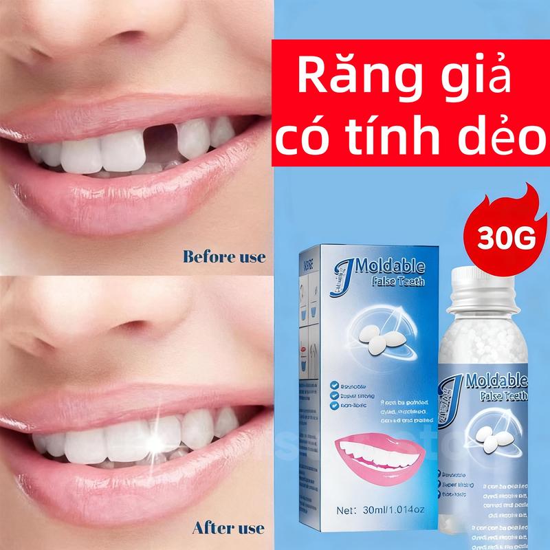 Jaysuing Kẹo Trám Răng Tạm Thời Dán Hình Nhanh 30ml | Dễ Sử Dụng | Trám Răng…