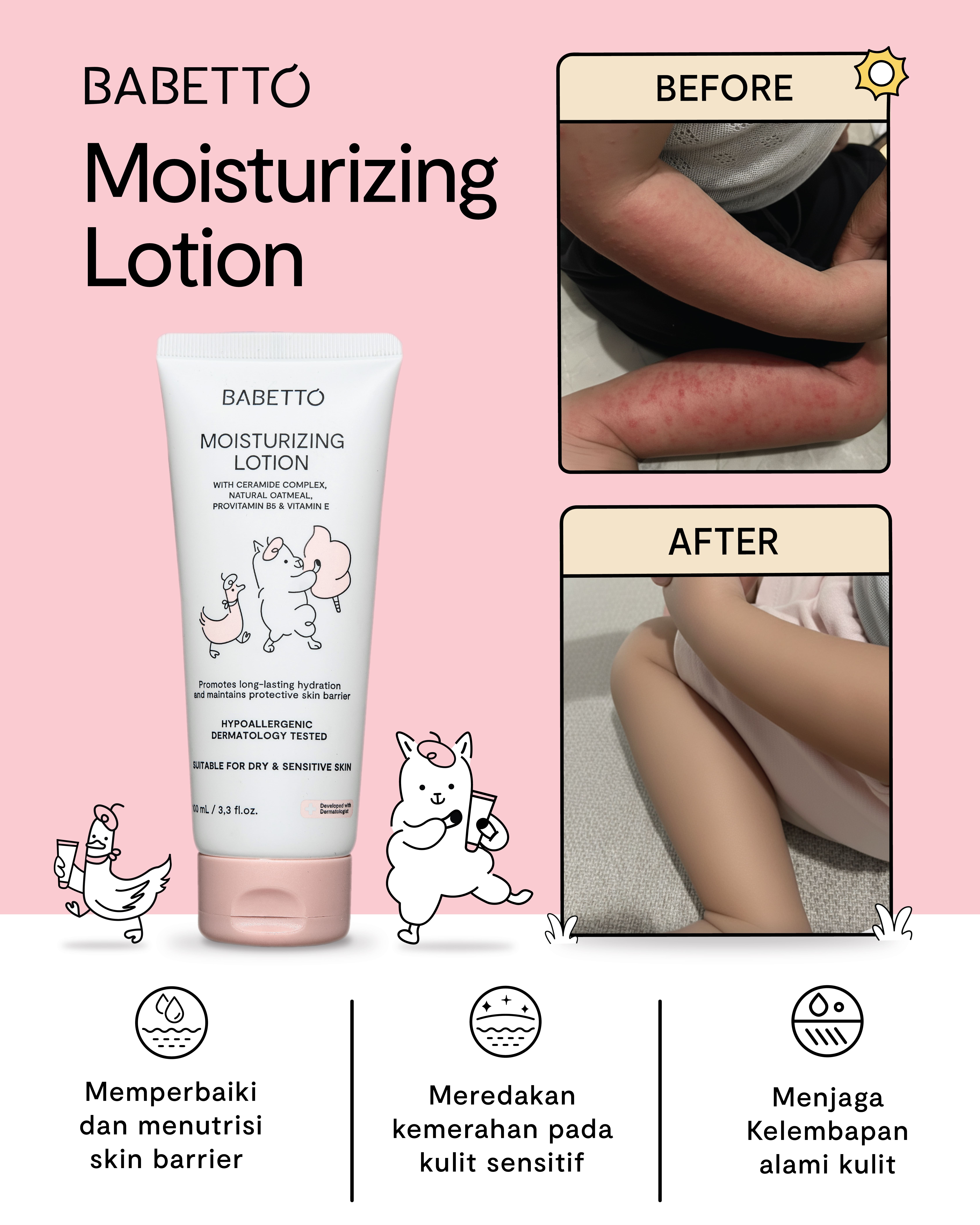 BABETTO Lotion Pelembab Bayi 100ml dengan Ceramide Complex & Provitamin B5 Perawatan Kulit Kering & Sensitif Dermatologist Tested Hypoallergenic