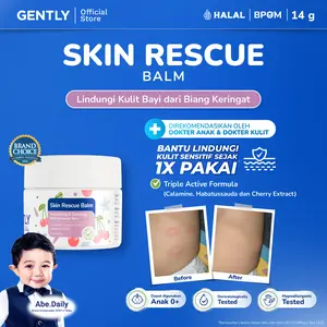 GENTLY  Skin Rescue Balm with Calamine, Cherry & Habbatussauda Extract | Baby Moisturizer | Pelembab & Skincare Anak Untuk Biang Keringat