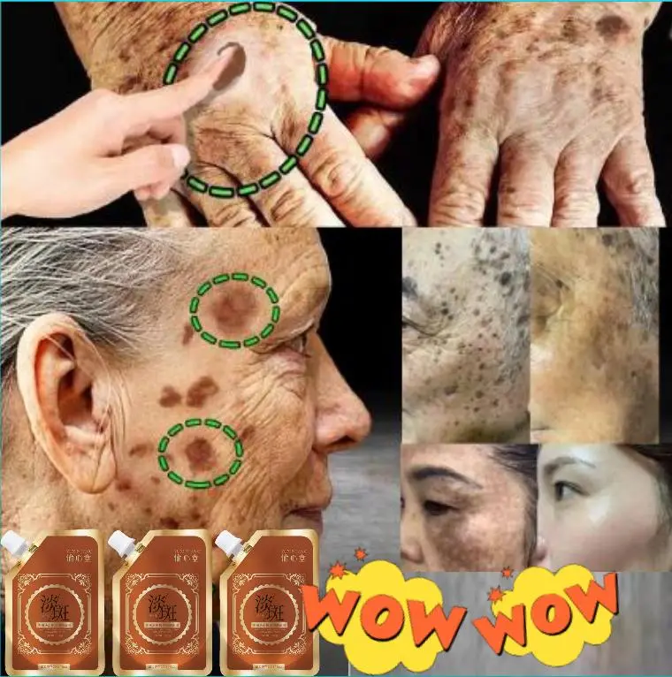 Beli 1 Gratis 1，merek Jepang XIBAN，[Resmi asli] Masker anti penuaan dan anti kerut, menghilangkan segala jenis flek dan noda hitam, serta mencegah jerawat tumbuh kembali，Bintang Korea menggunakan
