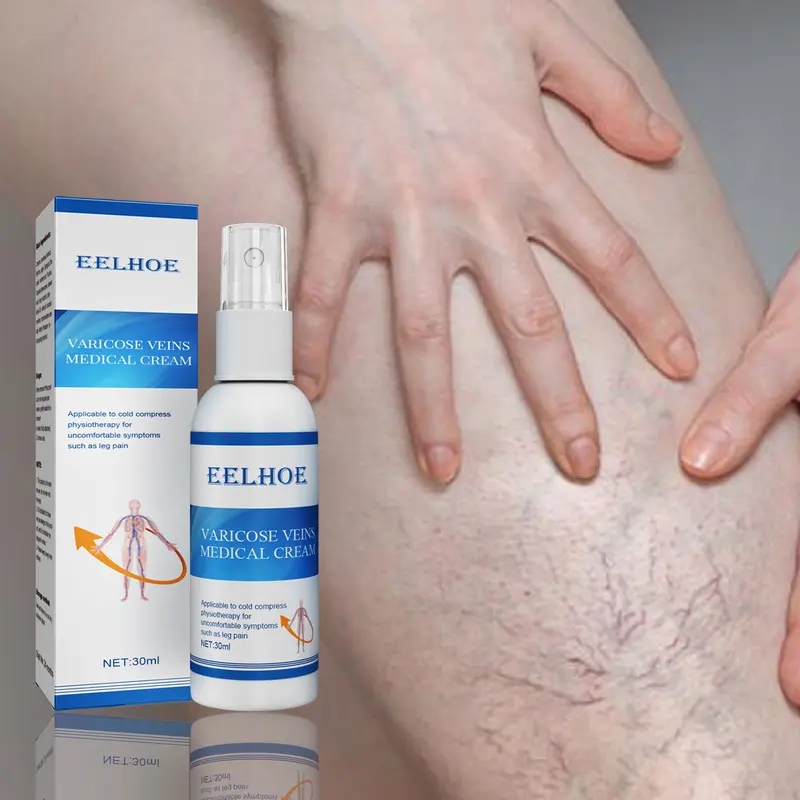 Intravenous massage spray for varicose veins relief and earthworm leg blood vessel bulge pain spray 1