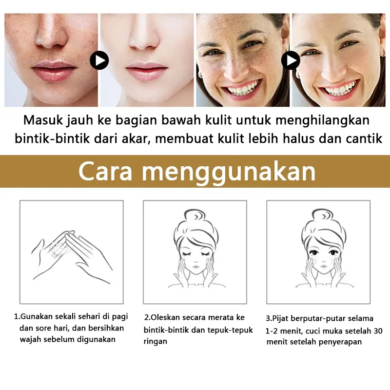 Krim penghilang flek hitam cream flek hitam membandel salep flek hitam membandel 30g menghilangkan flek hitam di wajah serum flek hitam Perawatan wajah Krim bintik Perbaikan bekas luka dan bintik bintik secara permanen dan efektif 7