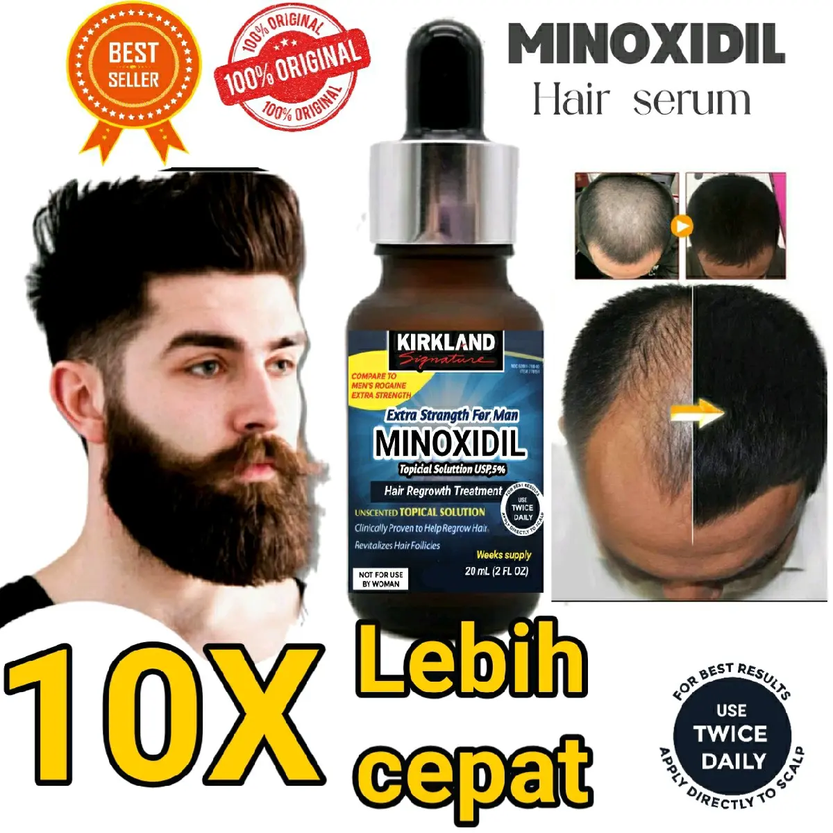 MINOXIDIL SERUM EXTRA 10X BY USA