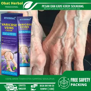 Pelembab tubuh melembabkan 20g Varicose Veins Cream Varicose Veins obat varises di kaki dan betis paling ampuh salep varises solusi varises di kaki betis menahun varises pecah verises bengkak varises gatal komplikasi ampuh manjur Varicose Veins Cream