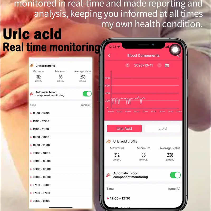 Jam tangan pintar Non-Invasive Blood Glucose Blood Lipid Uric Acid Smartwatch ECG Body Temperature Blood Pressure Monitoring Untuk Pria Wanita Bluetooth Call Tahan air Bracelet VS ET481 ET310 ET470 2
