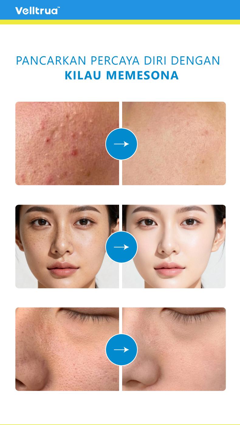 VELLTRUA Gel Penenang Kulit Gel Pengkondisi Kulit, Rawat Kulit Anda