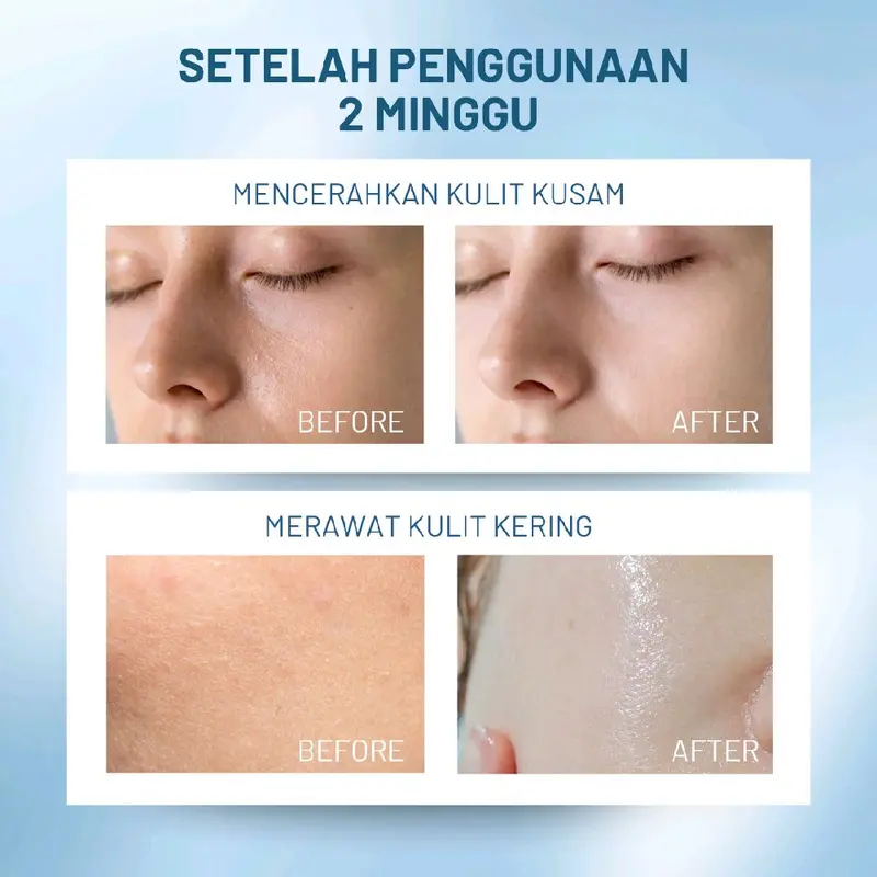 [PAKET BUNDLING] BEAUPHORA - Day Cream 30gr & Night Cream 30gr untuk Kulit Cerah 7 Hari, Anti-Aging, Melembapkan, BPOM NA18240115255 3