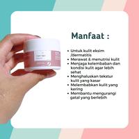 Gambar Leika Skincare Palm Skin Repair Cream Khusus Eksim Dermatitis Kulit Kering Mengelupas Telapak Kaki Kering Kulit Gatal Eksim Menghaluskan Kulit Kaki Dan Tangan Hand Perawatan Kulit Gatal Kulit Tangan Kasar Berminyak Mencerahkan dari Dinifaa Beauty Store Kota Cirebon 2 Tokopedia