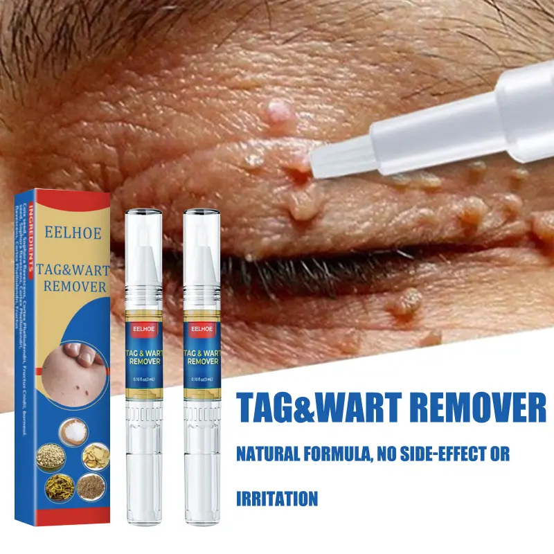 Wart Removal Pen Krim Penghilang Lalat, Krim Penghilang Kutil, Mudah Dibawa Untuk Semua Kulit, Krim Penghilang Kutil 1