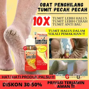 (BPOM) CREAM KAKI PENGHILANG KAPALAN KAKI MULUS TANPA PECAH PECAH