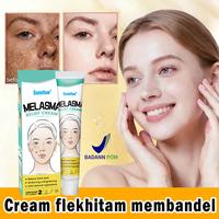 Gambar 【BPOM】Cream Pemutih Wajah Efektif Hilangkan Flek Hitam 20g anti-freckle Whitening Cream Penghilang Flek Hitam Membandel Niacinamide cream Siang Malam salep flek hitam Pemutih Wajah Krim Pemutih Penghilang Flek Hitam membandel - 20ML dari Sumifun Beauty Indonesia Kab. Bekasi 1 Tokopedia
