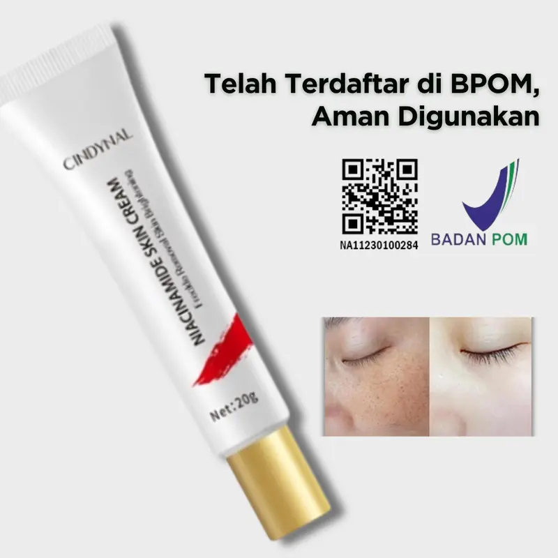 [100% Original] Cindynal Niacinamide Cream, Remove Freckles & Dark Spot | Penghilang Flek dan Bintik Hitam, Memudarkan Bekas Jerawat 1