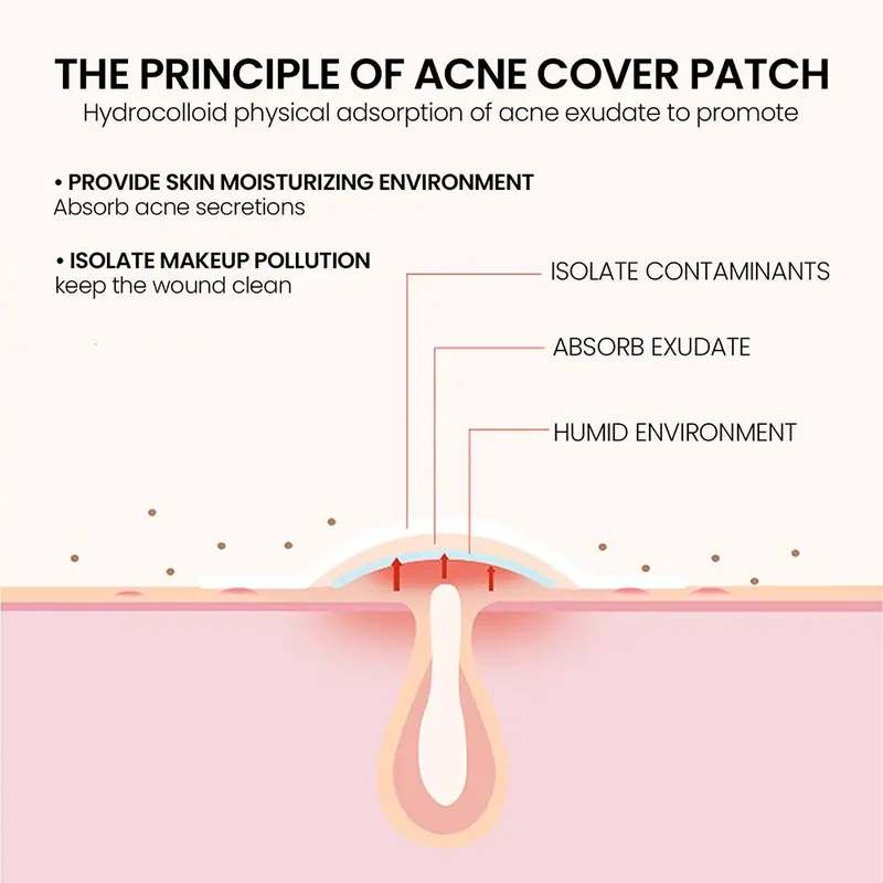 144pcs heart moon shaped acne patches cute acne sticker Tempelan Jerawat Jerawat patch 2