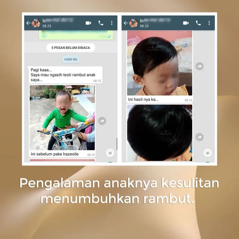 HazelOile Serum Hair Oil NCOM Night Care Oil Mask Repair Treatment Masker Malam Anti Kerontokan Rontok Rambut Uban Botak Pitak Bayi Anak Meluruskan Menebalkan Perawatan Wanita Vitamin Kering Ketombe Botak Pitak Haircare Rambut 4