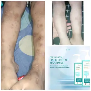 Infused Whitenning & Moisturizing Body Lotion Zam2jk