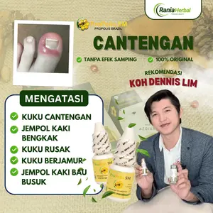 Tetes Cantengan Bernanah Pada Jempol Kaki Bengkak Kuku Rusak Jamuran Dengan Propolis Sm Isi 6ml