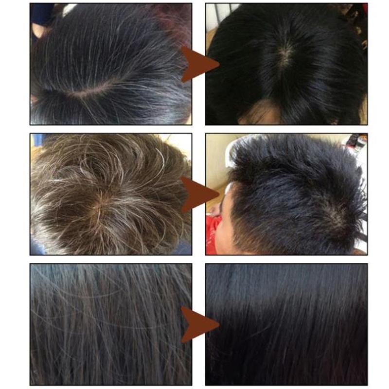 Product Introduction of Syampu rambut berkhasiat, sabun polygonum, bar syampu menggelapkan rambut, Pembersihan rambut organik semulajadi, sabun penjagaan rambut buatan tangan 3