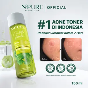 (CICA) NPURE Hydrating Acne Toner 30ml - Travel Size /Hydrating Toner/Acne Toner/Toner Kulit Jerawat/Toner Melembabkan/toner kit/toner basic/toner no 1 jerawat/skincare basic/skincare berjerawat/skincare kulit berminyak/ Mencerahkan Wajah/ Perawatan Acid