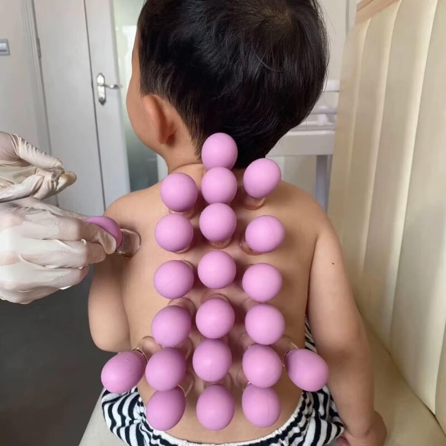 Alat bekam wajah, alat bekam silikon, alat pengangkat, cangkir pijat, cangkir bekam rumah tangga, cangkir kerokan, cangkir bekam vakum untuk kecantikan.