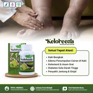 Obat Kaki Bengkak Karena Gula / Diabetes, Asam Urat, Ginjal, Jantung, Penumpukan Cairan - Keloreena