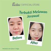 Gambar Fanbo Acne Solution Facial Foam (DP) - 100ml - Acne Facial Foam - Sabun Cuci Muka Untuk Kulit Jerawat Dan berminyak - Mengontrol Minyak Berlebih - Melembabkan, membuat kulit bersih kesat tanpa rasa kering - 1 pcs dari Fanbo Kota Administrasi Jakarta Barat 5 Tokopedia