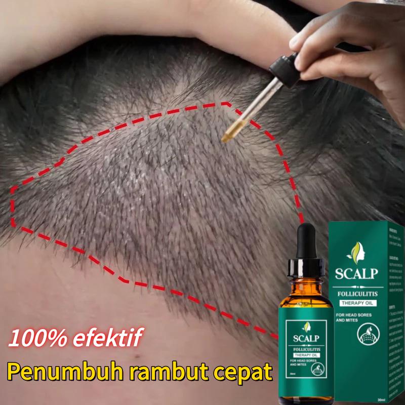 Serum rambut rontok Penumbuh rambut botak Hair serum rambut rontok Hair growth serum Hair Oil Rambut Rontok dan Kering Menutrisi Kulit Kepala - Gel Lidah Buaya