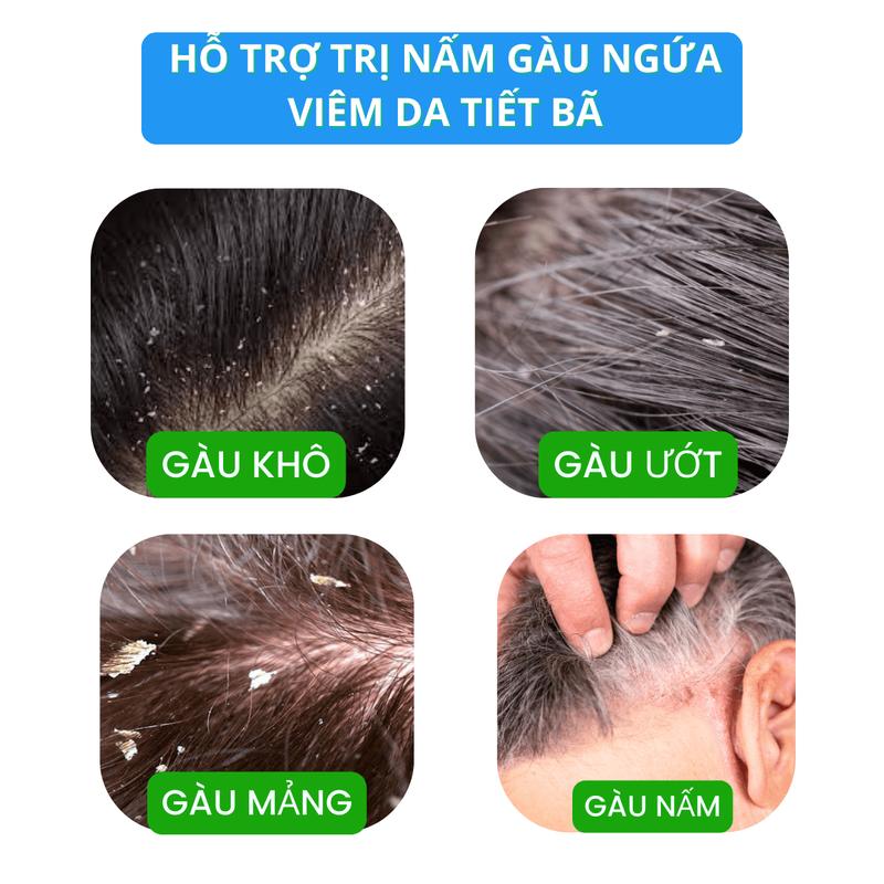 Product Introduction of Chuyên Nấm Gàu Viêm Da Tiết Bã - Dầu Gội Kem Bôi Canova Rivescal DS Nhập Khẩu Chính Hãng Từ Ý 30
