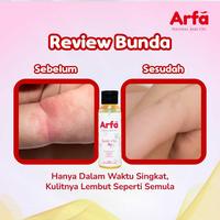 Gambar [BUNDLING] ARFA BABY OIL + ARFA HAIR NOURISH OIL SERUM - Membantu Merangsang Pertumbuhan Rambut Bayi dari ARFA BABY OIL STORE Kota Tangerang Selatan 5 Tokopedia