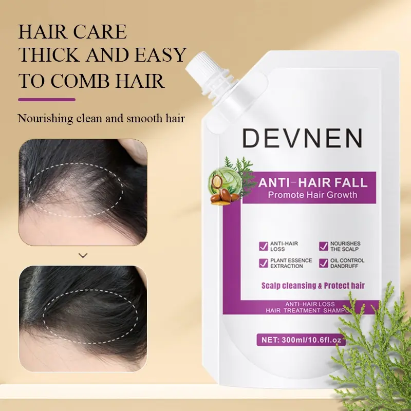 DEVNEN sampo anti rambut rontok 300ML Hair Growth Shampoo shampo penumbuh rambut cepat Anti rambut rontok Botak ginger shampoo kontrol minyak menyegarkan pelembab nutrisi Conditioner Haircare Ketombe Lebat 6
