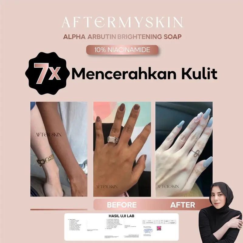 【Official Distributor】AFTERMYSKIN - 1 pcs HB Alpha Arbutin dan 1 pcs Sabun 10x Whitening Extra Chromabright Bodycream Lotion Dosting Pencerah Pemutih Bodycare Viral Original Afterskin After Skin By Andhitairianto 6