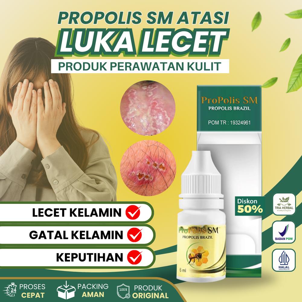 Cairan Tetes Untuk Lecet Luka Gatal dan Perih Miss V, Nyeri Iritasi, Keputihan Bau dan Becek - Perawatan Wanita Feminine Hygiene Kewanitaan - Propolis SM