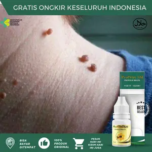 Kutil Papiloma di Leher, Perontok Kutil Dileher, Penghilang Papiloma, Papiloma di Wajah, Pengempis Papiloma, Kutil Papiloma, Skin Tag Kondiloma, Penghilang Virus Human Papilloma