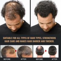 Gambar 100ml Root Activating Shampoo Penebalan Rambut Perawatan Pertumbuhan Kembali Anti Rambut Rontok - 1PCS dari Polkadope Indonesia Kota Tangerang 4 Tokopedia