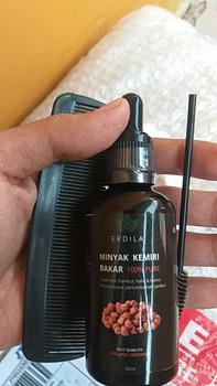 Product Review of Minyak Kemiri bakar murni Erdila penumbuh rambut 100% PURE ORIGINAL Menebalkan Menumbuhkan from S**o 3