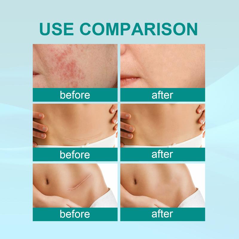 Product Introduction of South Moon   Semprotan perawatan kulit menghaluskan kulit untuk melembabkan kulit dengan semprotan perawatan kulit yang halus dan berkilap Wajah 7