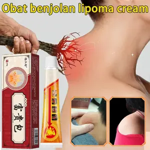Pelembab tubuh pelembab Obat benjolan 20g obat lipoma obat benjolan di leher Benjolan Lipoma Luar Lemak Menghilangkan salep benjolan Obat Benjolan lipoma obat benjolan payudara Meredakan Tonjolan Benjolan Padat 100% asli