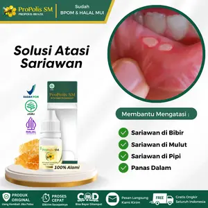 Propolis SM - Solusi Atasi Sariawan di Bibir, di Lidah, Sariawan di Pipi Bagian Dalam, Sariawan di Bawah Bibir Atasi Dengan Propolis SM HALAL BPOM