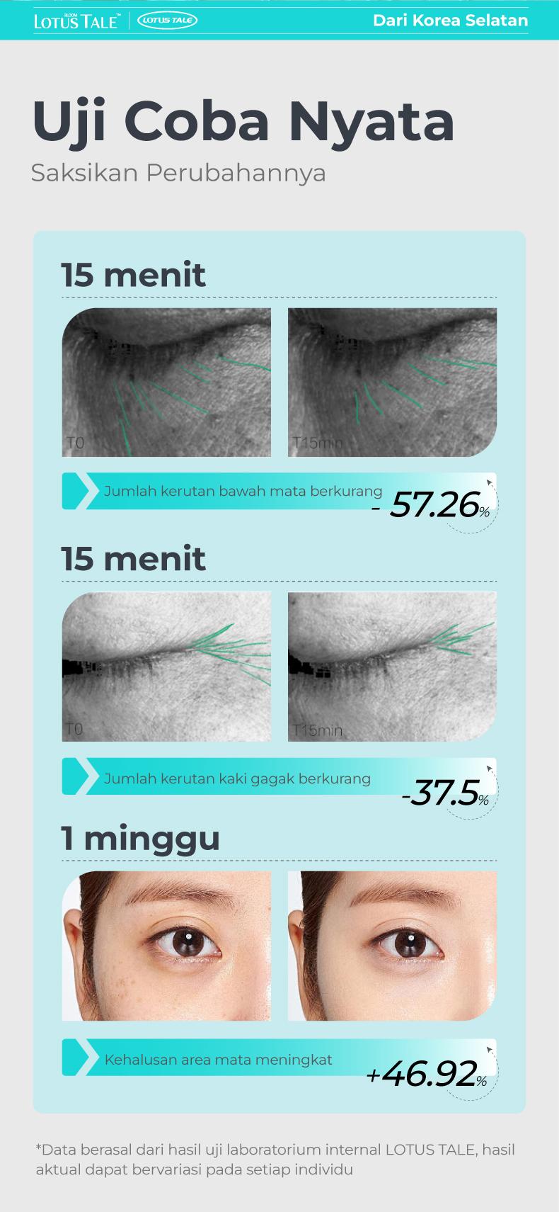 Eye Patch Anti Puffy Eyes untuk Mata Bengkak | Kurangi Tampilan Kantung Mata | Caffeine + Ginseng + Ectoin + Centella (7 Pairs) Eye Patch Anti Puffy Eyes untuk Mata Bengkak | Kurangi Tampilan Kantung Mata | Caffeine + Ginseng + Ectoin + Centella (7 Pairs)