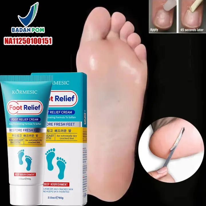 krim kaki pecah dan kering collagen Foot cream Obat kaki pecah