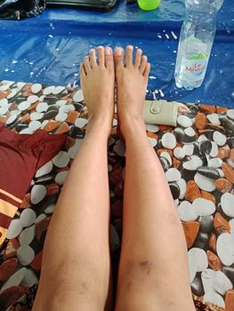Product Review of ESASKIN (Paket) Peeling Spray dan Body Serum - Spesial Kulit Belang Mencerahkan Tubuh Serum Badan Kaki tangan from X**_ 1