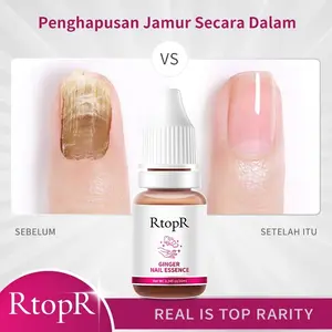 【BPOM & COD】RtopR Jahe Antibakteri Perawatan Kuku Onikomikosis Paronychia Anti Infeksi Kuku Toe Nail Pengobatan Jamur Minyak Esensial Ginger Antibacterial Nail Essential Oil