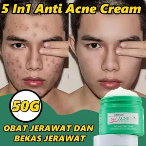 5 In1 Anti Acne Cream 50G Mengandung Niacinamide & Salicylic Acid & Centella Asiatica Calendula Officinalis & Extract,Kurangi Jerawat & Minyak,Anti Jerawat Pemutih Penghilang Flek Hitam Penghilang Jerawat Hapus Komedo Mengecilkan Poripori Kontrol Minyak